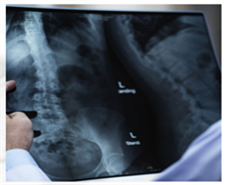 Das Bild zeigt die Röntgenaufnahme einer Wirbelsäule.